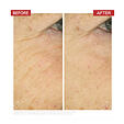 Dr. LEVY Intense Stem Cell Booster Cream 50 ml
