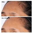 Perricone MD High Potency Hyaluronic Intensive Hydrating Mask 59 ml